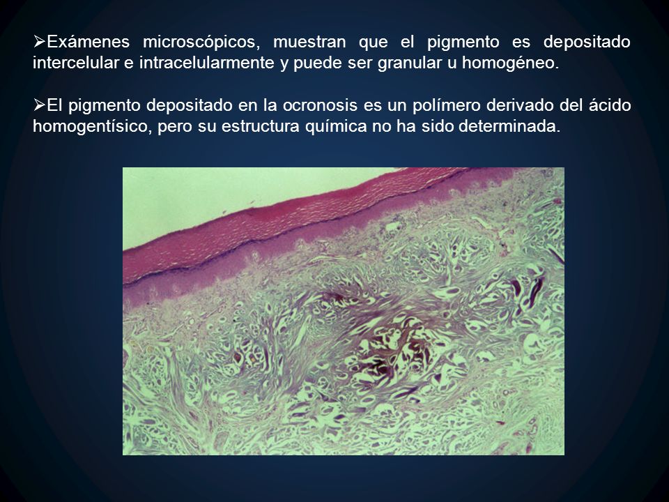 Exámenes microscópicos, muestran que el pigmento es depositado intercelular e intracelularmente y puede ser granular u homogéneo.