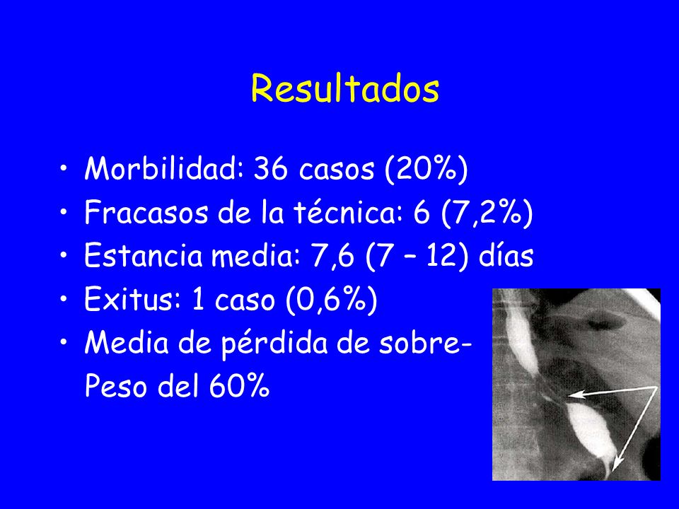 Resultados Morbilidad: 36 casos (20%) Fracasos de la técnica: 6 (7,2%)