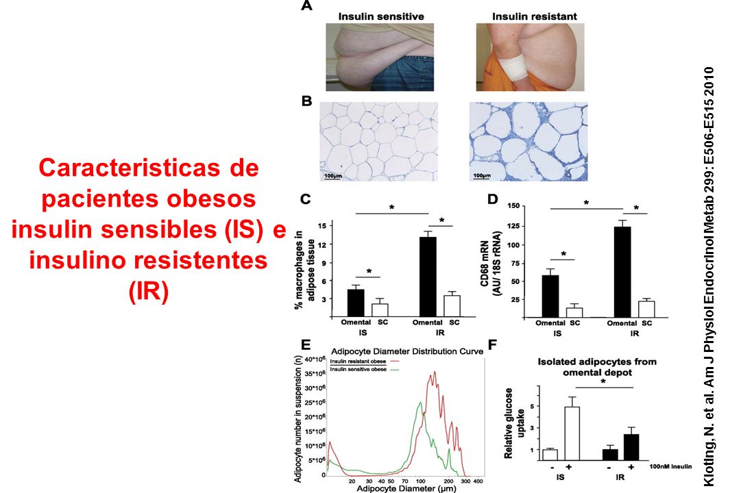 Caracteristicas de pacientes obesos insulin sensibles (IS) e insulino resistentes (IR)