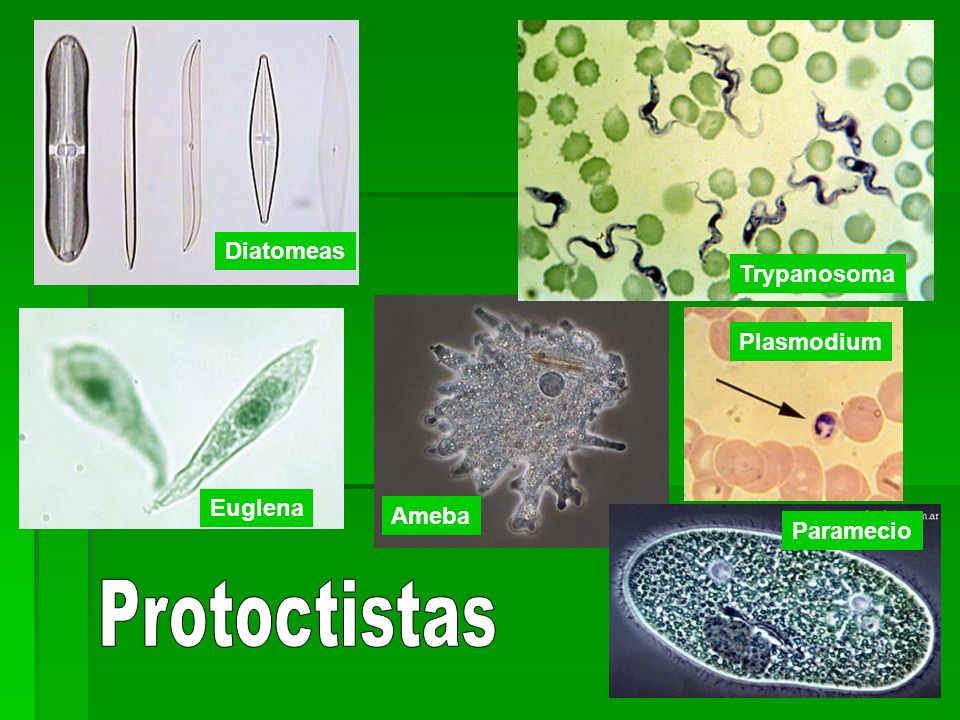 Diatomeas Trypanosoma Plasmodium Euglena Ameba Paramecio Protoctistas