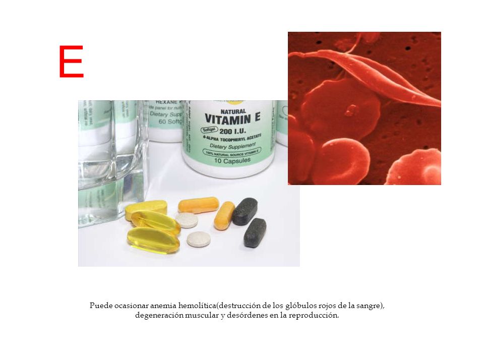 E Puede ocasionar anemia hemolítica(destrucción de los glóbulos rojos de la sangre), degeneración muscular y desórdenes en la reproducción.