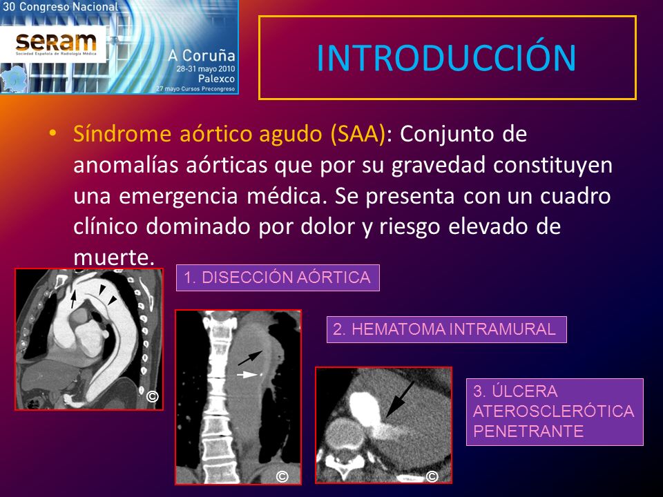 INTRODUCCIÓN