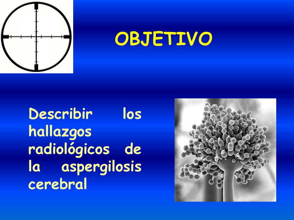 OBJETIVO Describir los hallazgos radiológicos de la aspergilosis cerebral