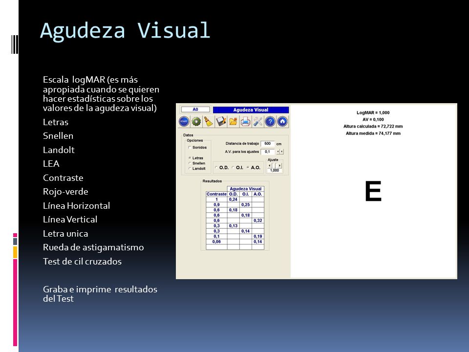Agudeza Visual Escala logMAR (es más apropiada cuando se quieren hacer estadísticas sobre los valores de la agudeza visual)