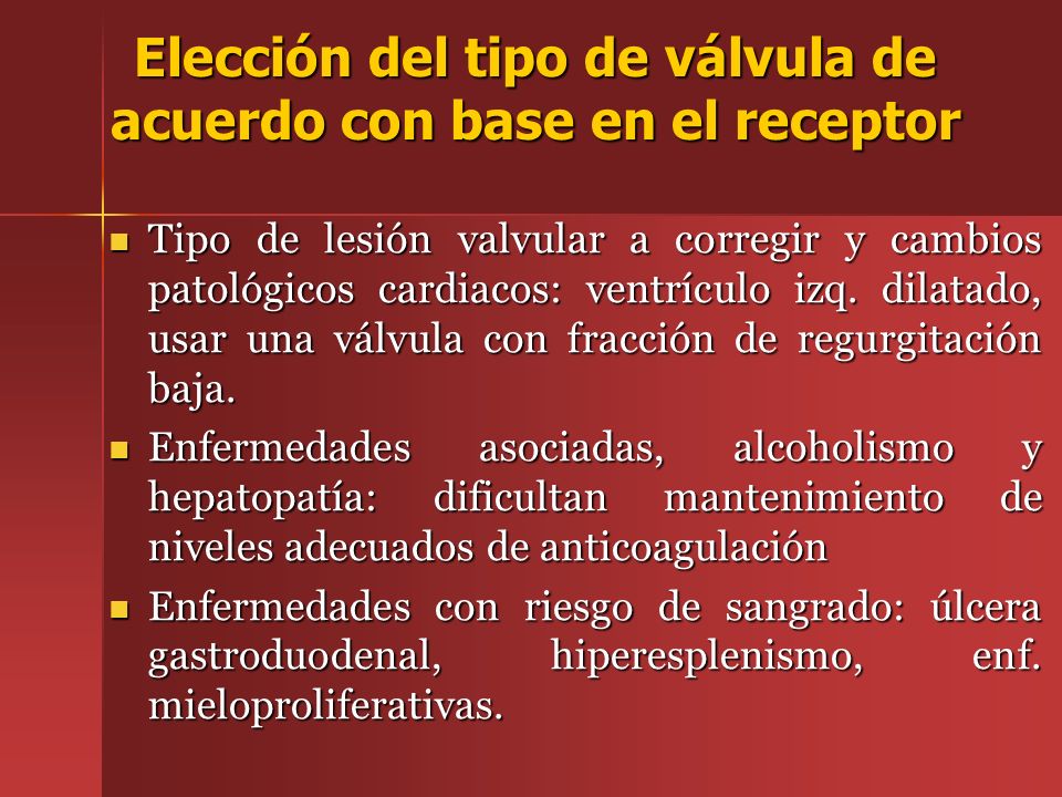 Elección del tipo de válvula de acuerdo con base en el receptor