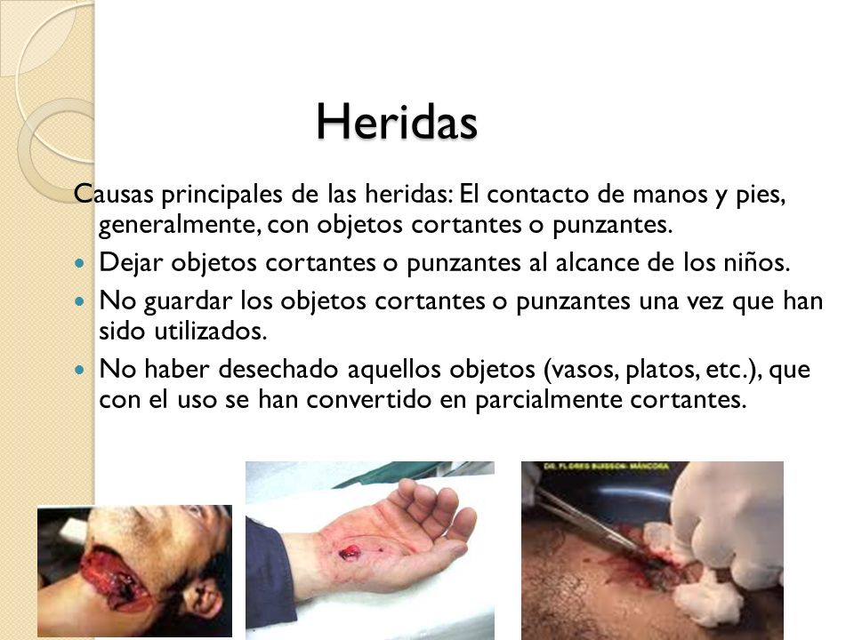 Heridas Causas principales de las heridas: El contacto de manos y pies, generalmente, con objetos cortantes o punzantes.