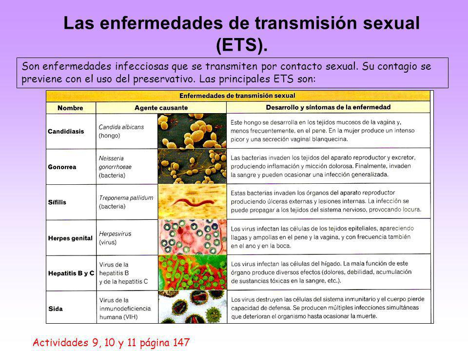 Las enfermedades de transmisión sexual (ETS).