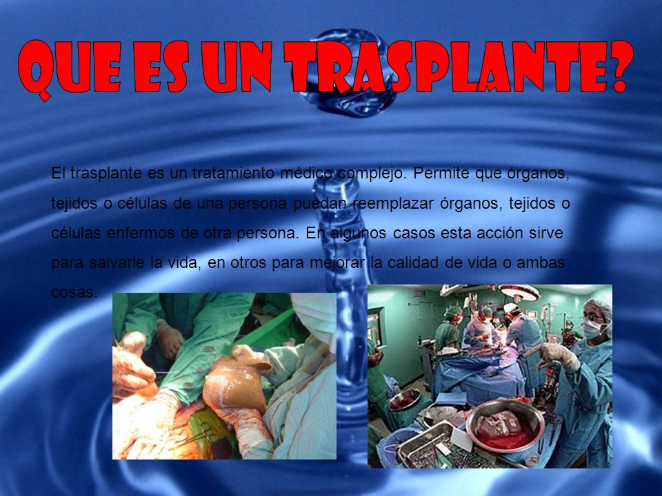que es un trasplante El trasplante es un tratamiento médico complejo. Permite que órganos,