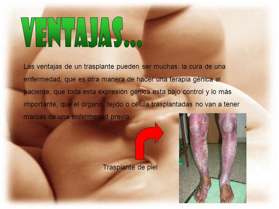 ventajas... Las ventajas de un trasplante pueden ser muchas: la cura de una. enfermedad, que es otra manera de hacer una terapia génica al.