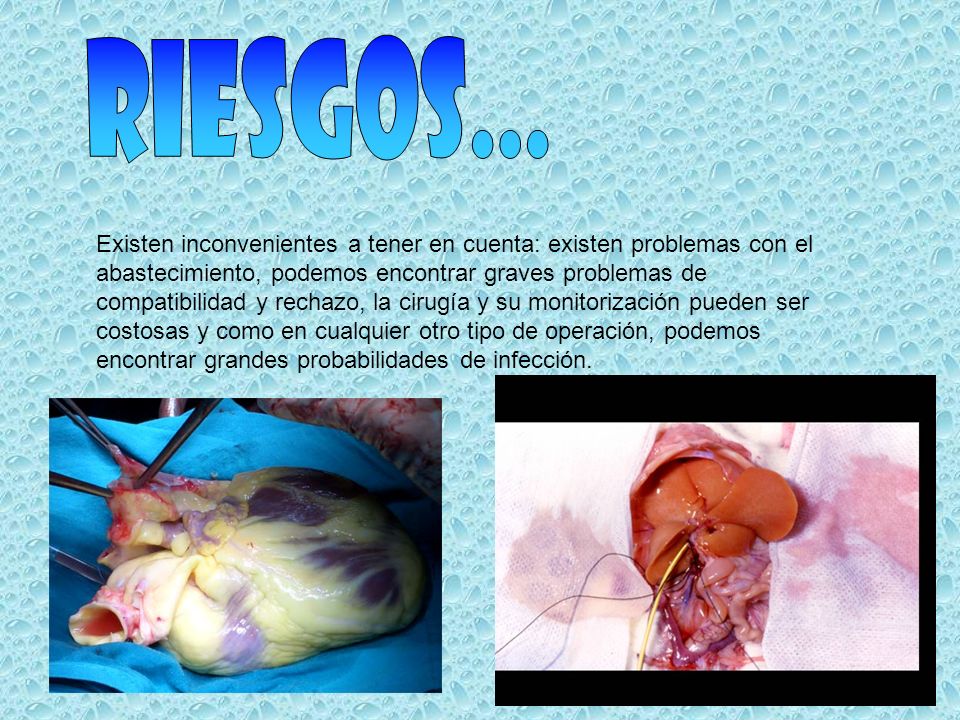 riesgos... Existen inconvenientes a tener en cuenta: existen problemas con el. abastecimiento, podemos encontrar graves problemas de.