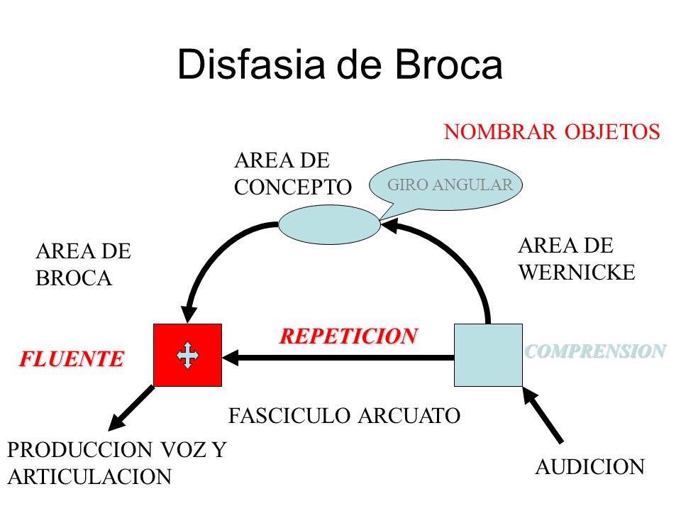 Disfasia de Broca NOMBRAR OBJETOS AREA DE CONCEPTO AREA DE WERNICKE