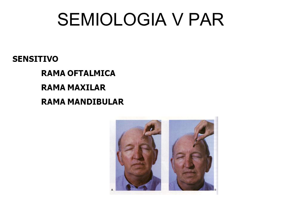 SEMIOLOGIA V PAR SENSITIVO RAMA OFTALMICA RAMA MAXILAR RAMA MANDIBULAR