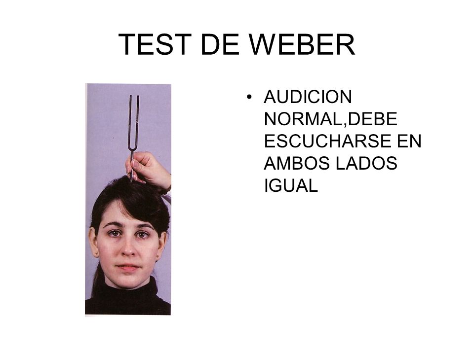 TEST DE WEBER AUDICION NORMAL,DEBE ESCUCHARSE EN AMBOS LADOS IGUAL