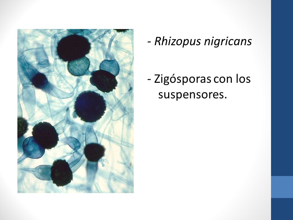 - Rhizopus nigricans - Zigósporas con los suspensores.
