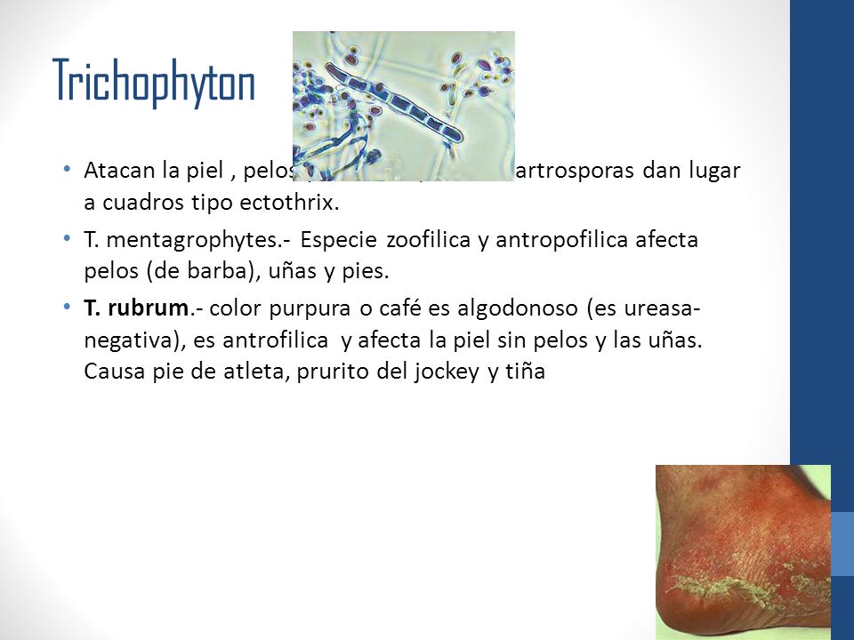 Trichophyton Atacan la piel , pelos y uñas. En pelos las artrosporas dan lugar a cuadros tipo ectothrix.