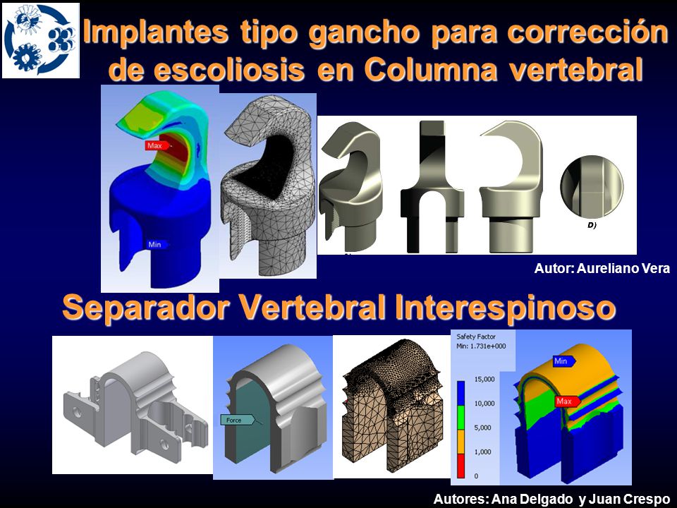 Futuro….Optimización Diseño de un fijador externo para alargamiento y