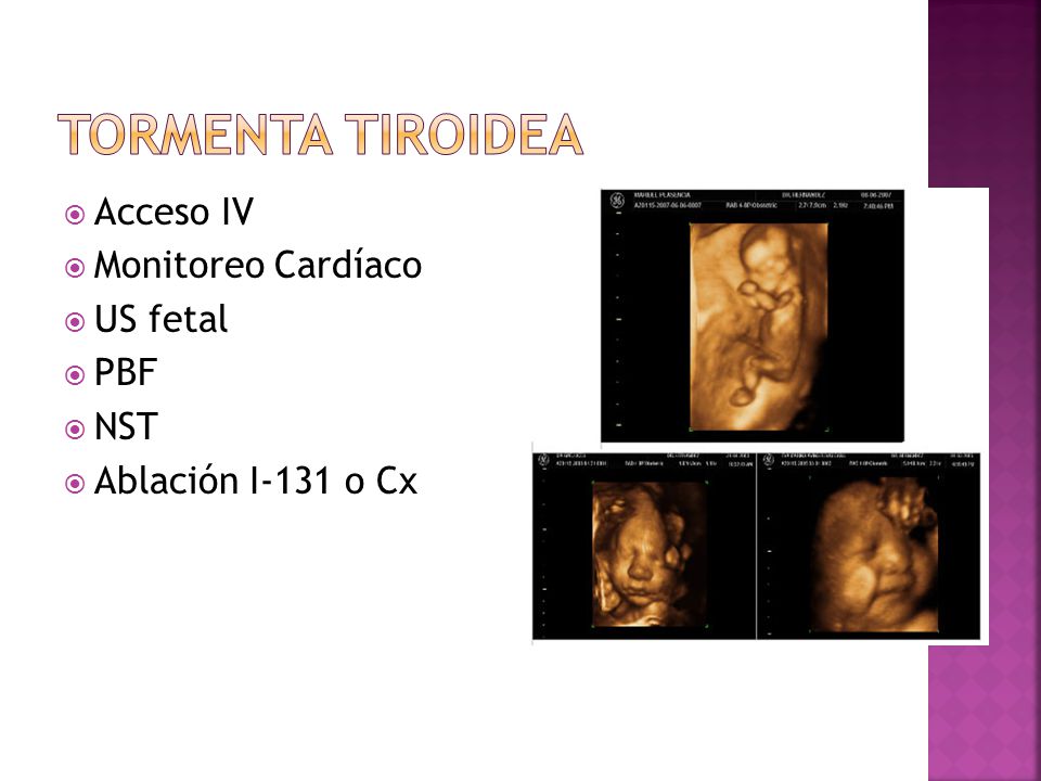 Tormenta Tiroidea Acceso IV Monitoreo Cardíaco US fetal PBF NST