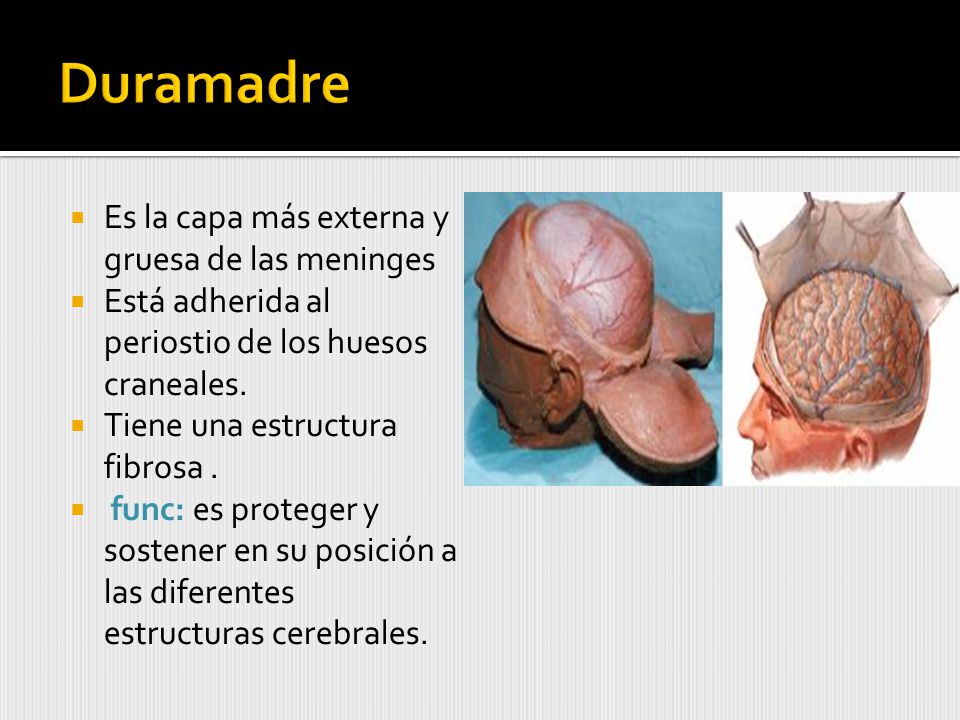 Duramadre Es la capa más externa y gruesa de las meninges