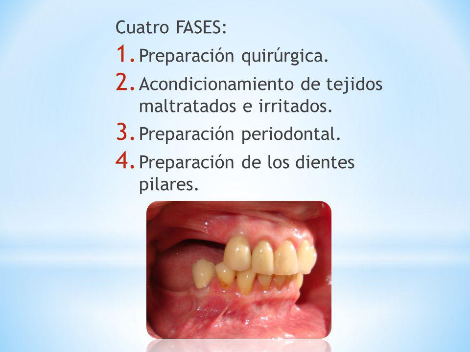 Cuatro FASES: Preparación quirúrgica. Acondicionamiento de tejidos maltratados e irritados. Preparación periodontal.