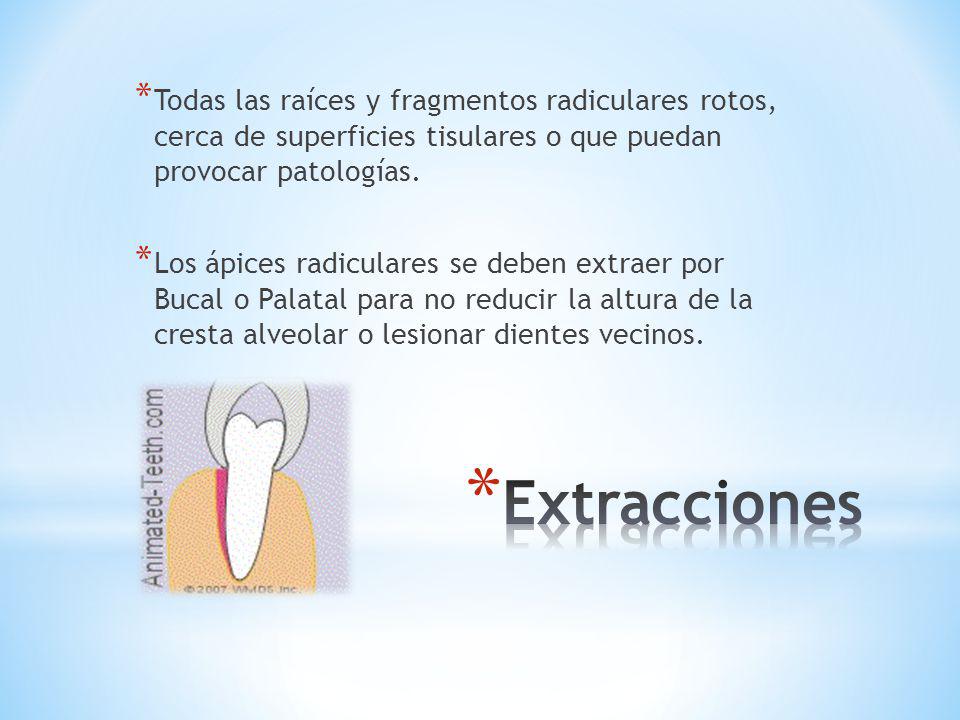 Todas las raíces y fragmentos radiculares rotos, cerca de superficies tisulares o que puedan provocar patologías.