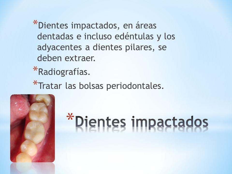 Dientes impactados, en áreas dentadas e incluso edéntulas y los adyacentes a dientes pilares, se deben extraer.