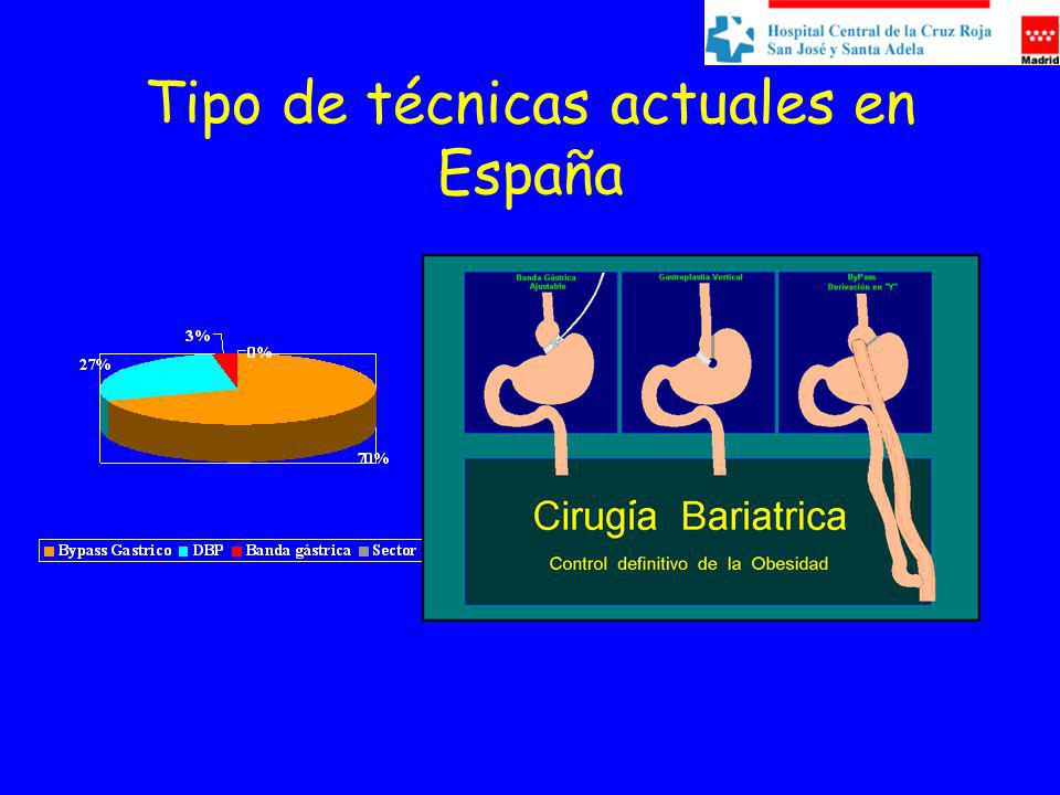 Tipo de técnicas actuales en España