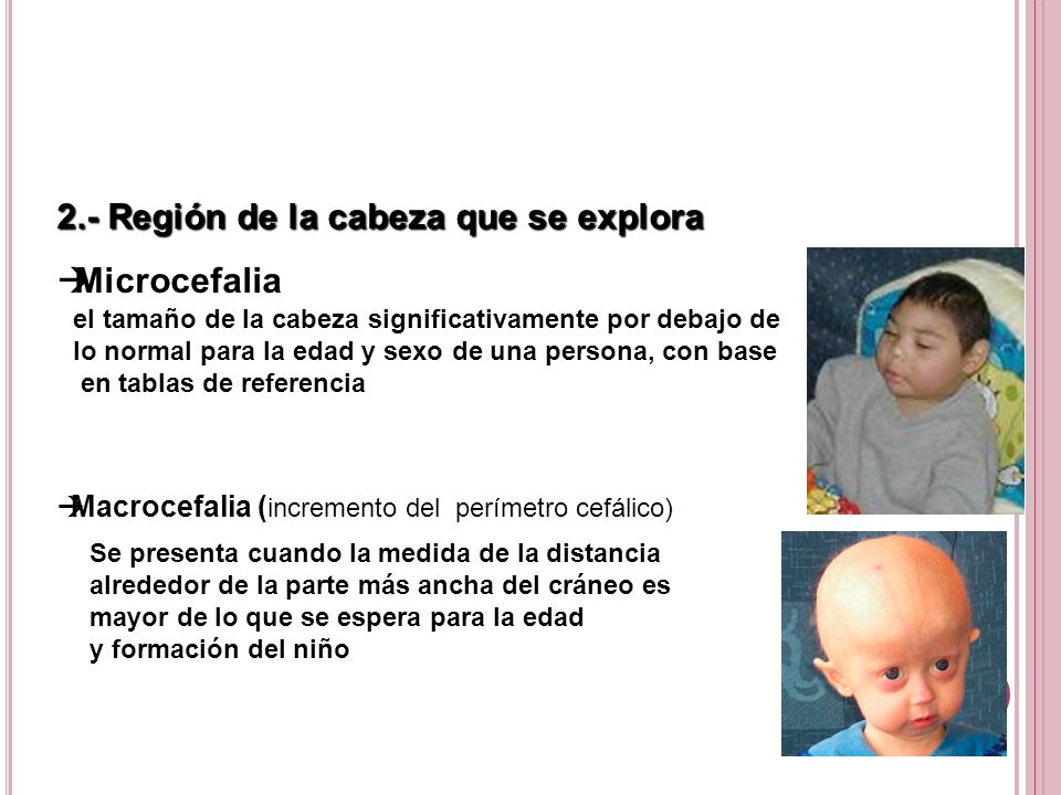 2.- Región de la cabeza que se explora Microcefalia
