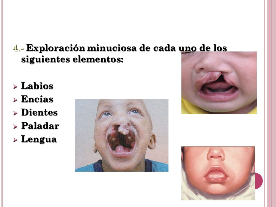 4.- Exploración minuciosa de cada uno de los siguientes elementos: