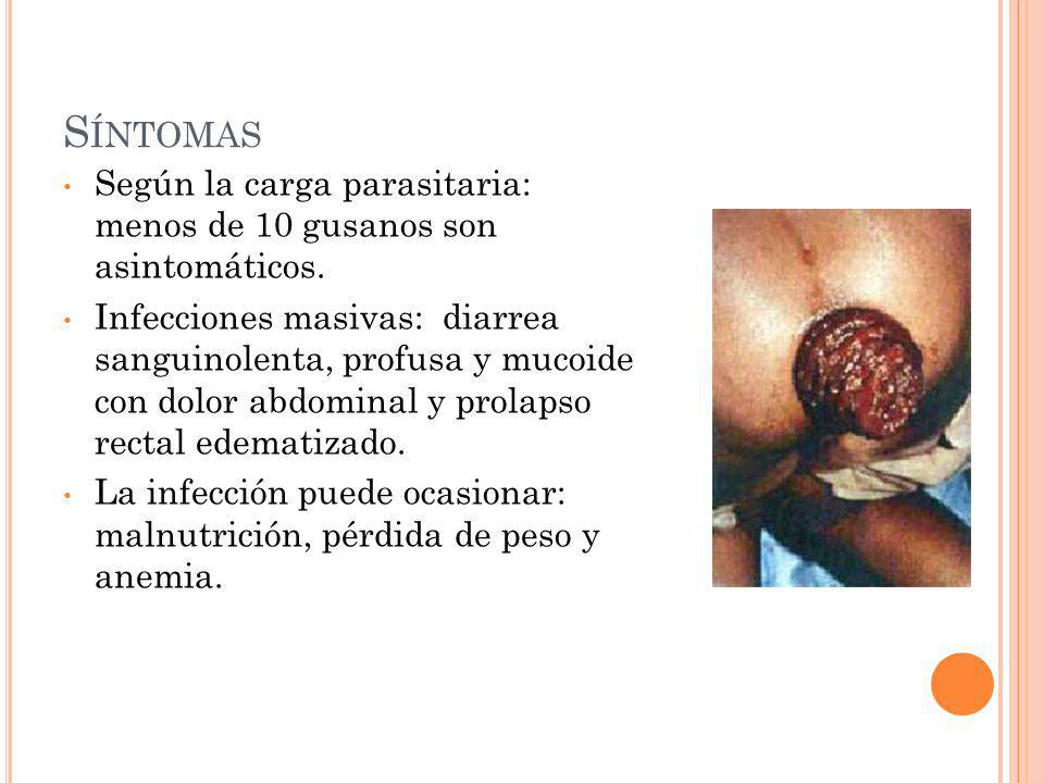Síntomas Según la carga parasitaria: menos de 10 gusanos son asintomáticos.