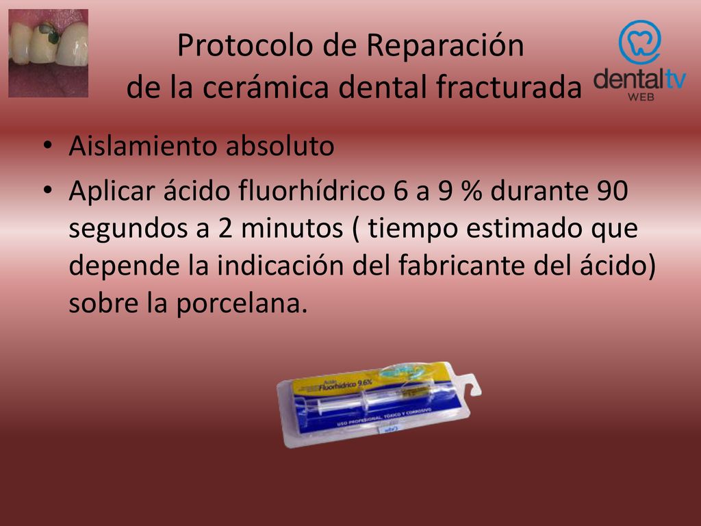 Protocolo de Reparación de la cerámica dental fracturada - ppt descargar