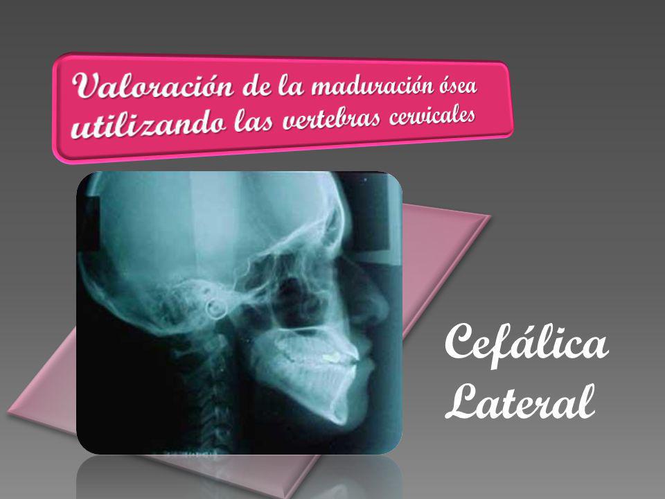 Valoración de la maduración ósea utilizando las vertebras cervicales