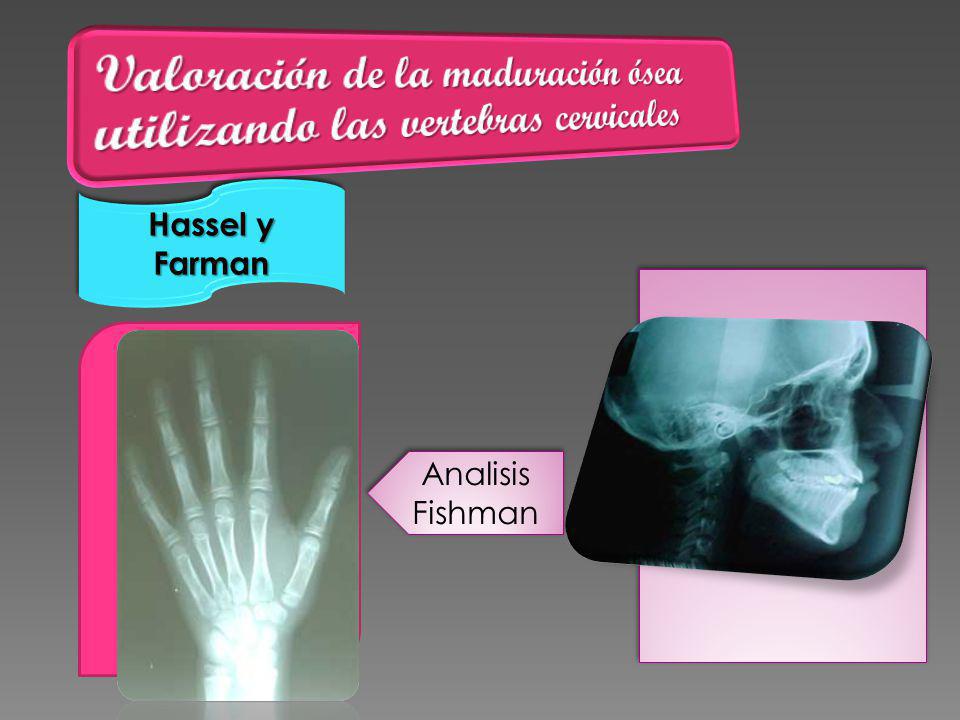 Valoración de la maduración ósea utilizando las vertebras cervicales