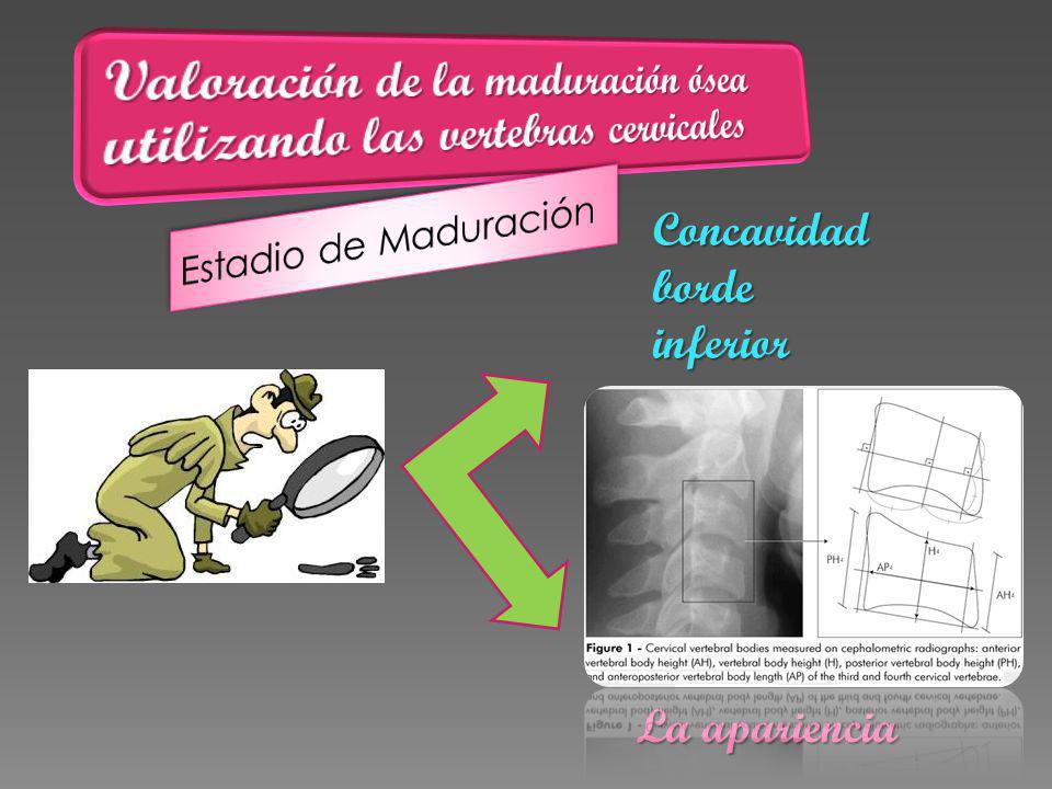 Valoración de la maduración ósea utilizando las vertebras cervicales
