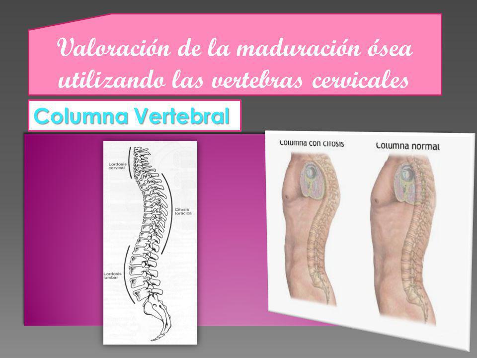 Valoración de la maduración ósea utilizando las vertebras cervicales