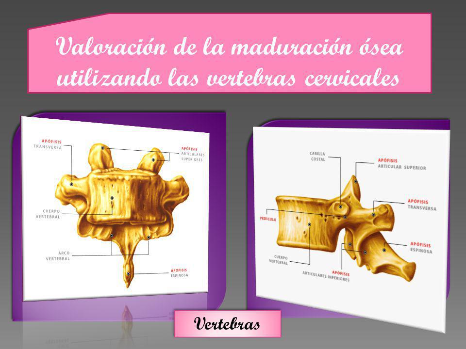 Valoración de la maduración ósea utilizando las vertebras cervicales