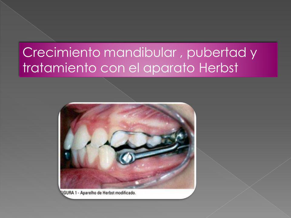 Crecimiento mandibular , pubertad y tratamiento con el aparato Herbst