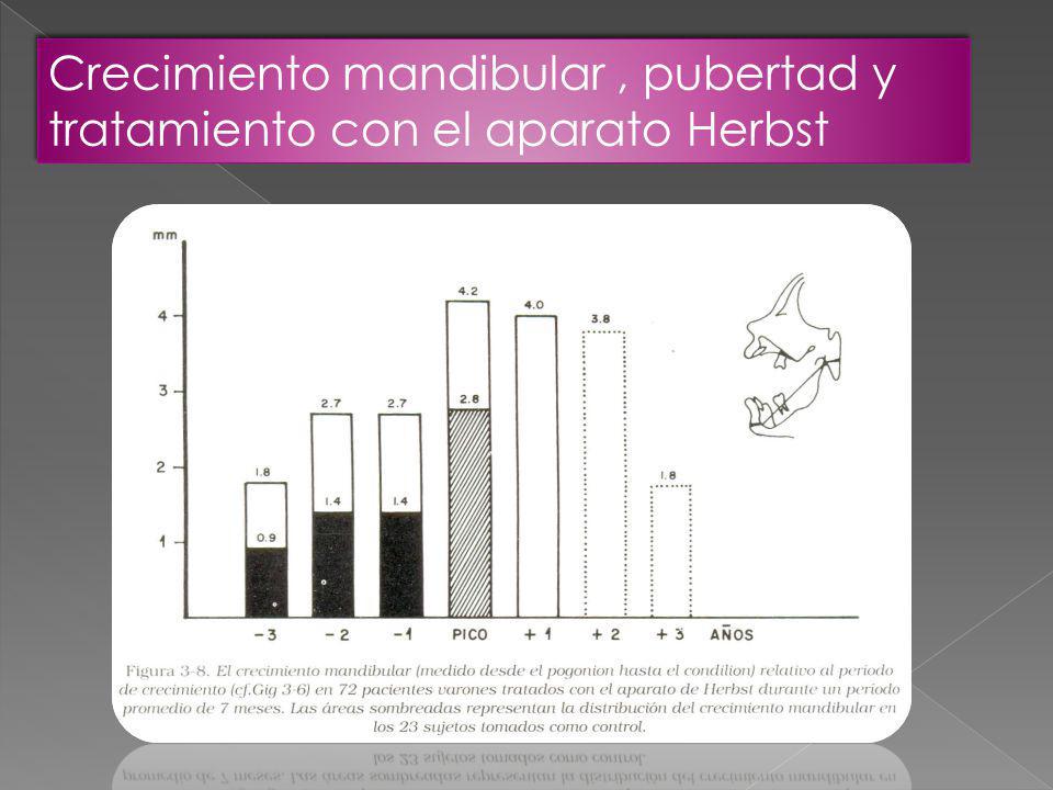 Crecimiento mandibular , pubertad y tratamiento con el aparato Herbst