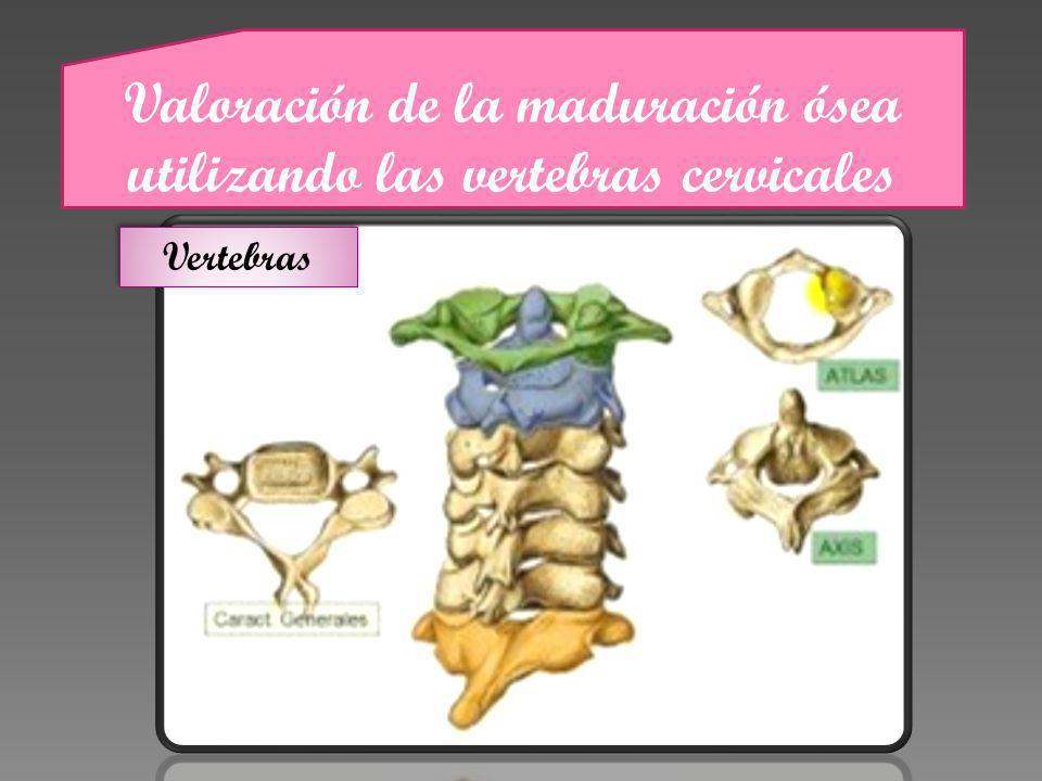 Valoración de la maduración ósea utilizando las vertebras cervicales