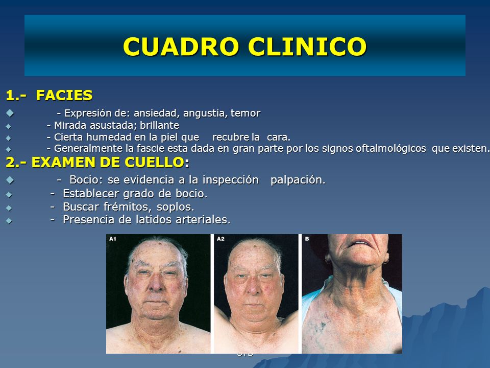 CUADRO CLINICO 1.- FACIES - Expresión de: ansiedad, angustia, temor