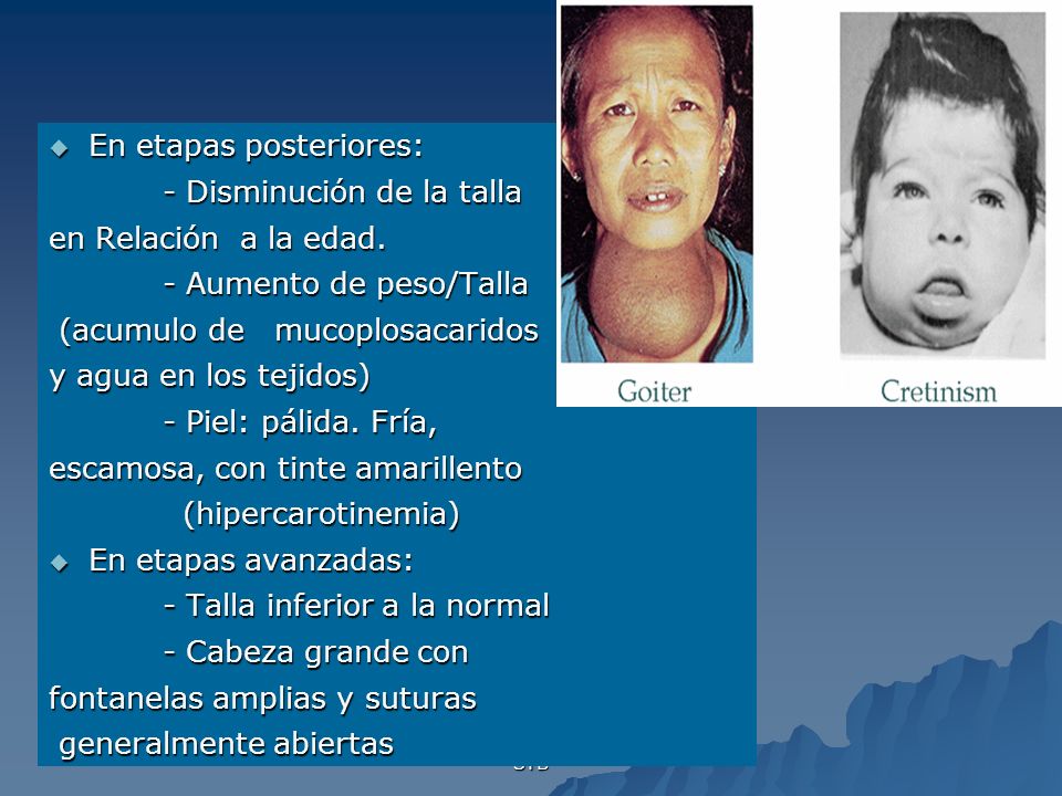 En etapas posteriores: - Disminución de la talla