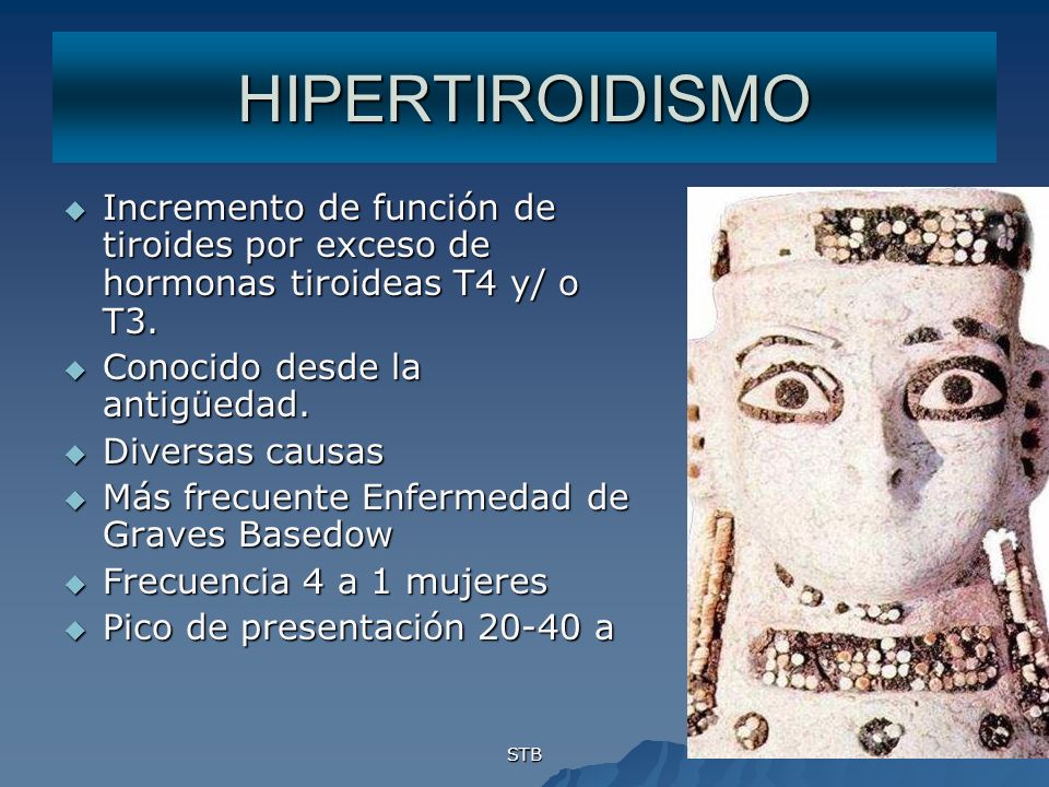 HIPERTIROIDISMO Incremento de función de tiroides por exceso de hormonas tiroideas T4 y/ o T3. Conocido desde la antigüedad.