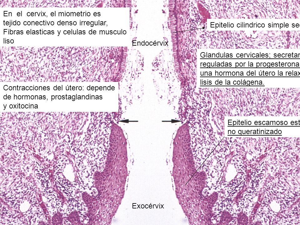 Exocérvix Endocérvix. En el cervix, el miometrio es. tejido conectivo denso irregular, Fibras elasticas y celulas de musculo.