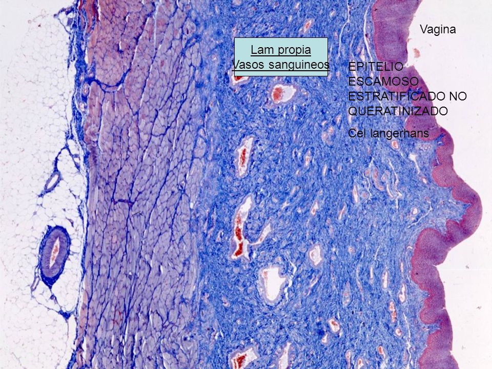 Vagina Lam propia Vasos sanguineos EPITELIO ESCAMOSO ESTRATIFICADO NO QUERATINIZADO Cel langerhans
