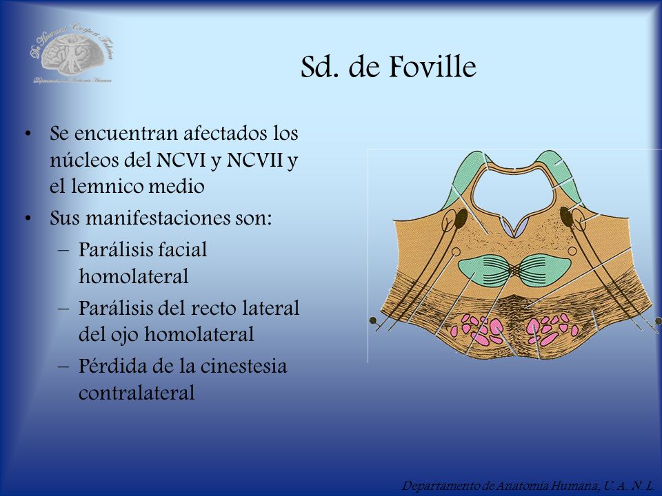 Sd. de Foville Se encuentran afectados los núcleos del NCVI y NCVII y el lemnico medio. Sus manifestaciones son: