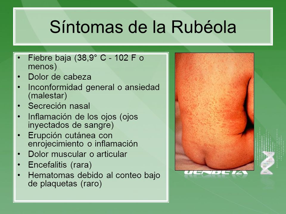Síntomas de la Rubéola Fiebre baja (38,9° C F o menos)