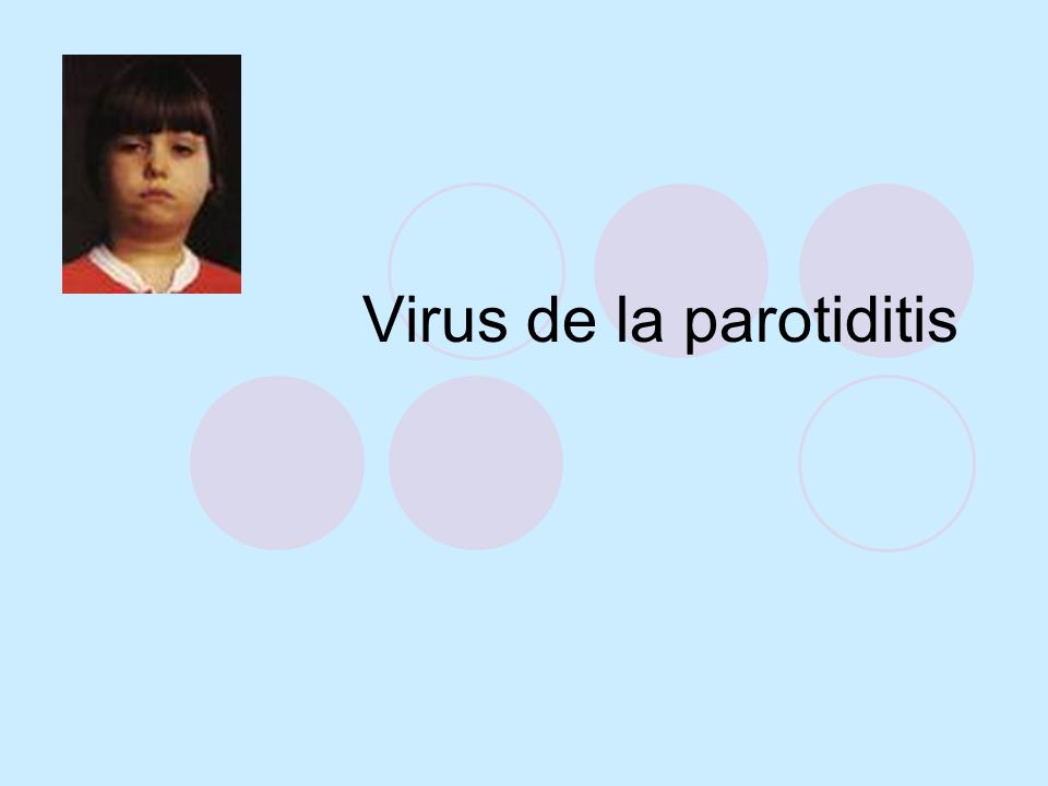Virus de la parotiditis