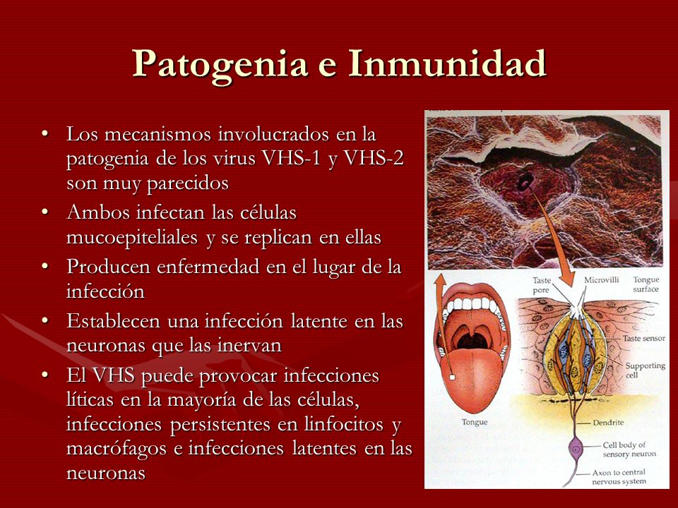 Patogenia e Inmunidad Los mecanismos involucrados en la patogenia de los virus VHS-1 y VHS-2 son muy parecidos.