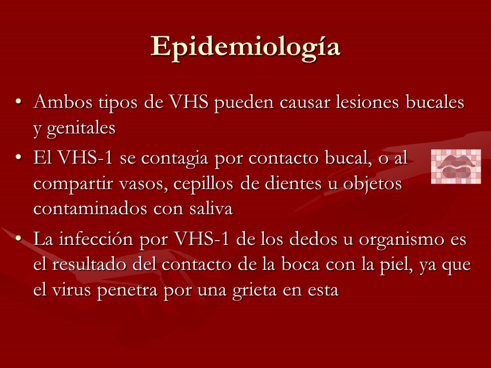Epidemiología Ambos tipos de VHS pueden causar lesiones bucales y genitales.