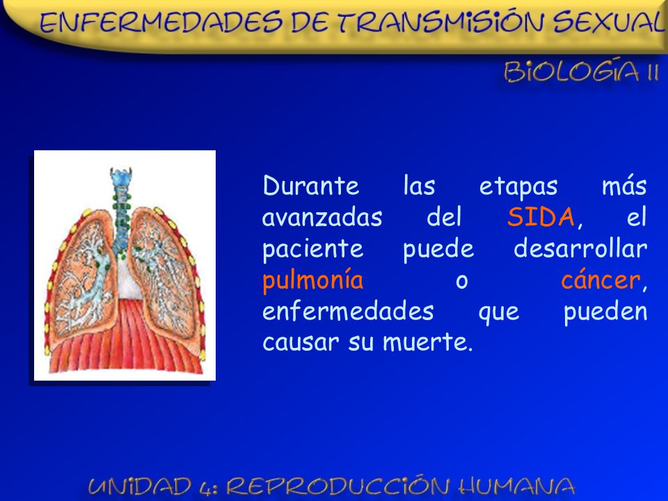 Durante las etapas más avanzadas del SIDA, el paciente puede desarrollar pulmonía o cáncer, enfermedades que pueden causar su muerte.