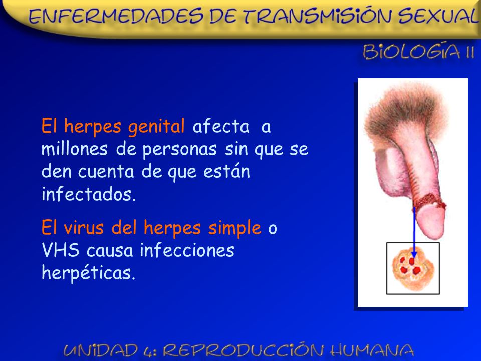 El herpes genital afecta a millones de personas sin que se den cuenta de que están infectados.